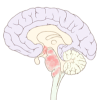 File:Brain Small McGarry Brain Autopsy.jpg