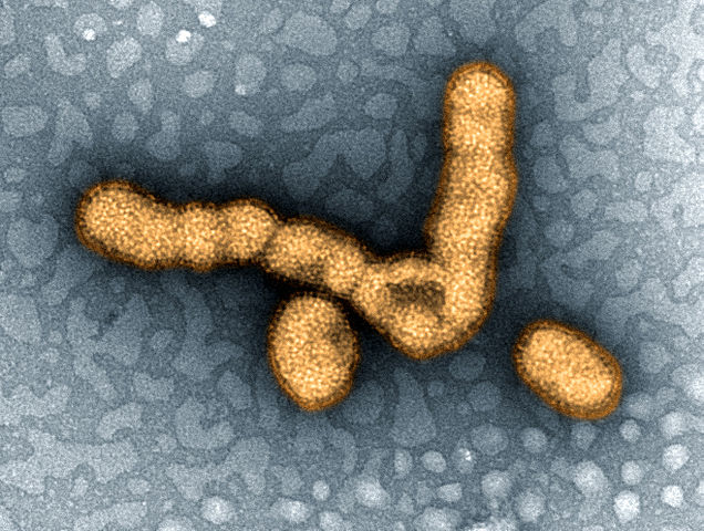 File:H1N1 virus particles II.jpg