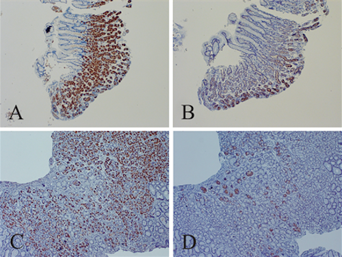 File:Enterovirus VP1 and dsRNA in stomach. John Chia 2015 paper.png