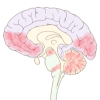 File:Brain Small Chia Brain Autopsy.jpg