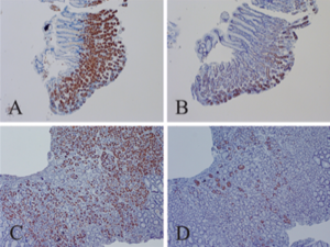 Enterovirus VP1 & dsRNA in stomach, Chia 2015. 400px.png