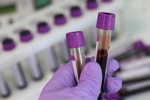 Hand holding tubes choosing blood samples